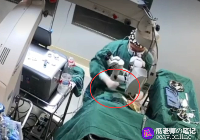 贵港爱尔眼科医院院长无良医师冯桂强术中暴打患者面部